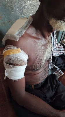 Siguiri : six personnes blessées par balle dans un affrontement entre deux hameaux